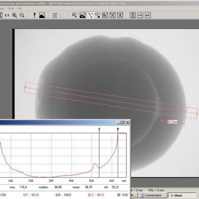 X-ray inspection of pearl – product & process control 3 X-ray inspection of pearl – product & process control 3